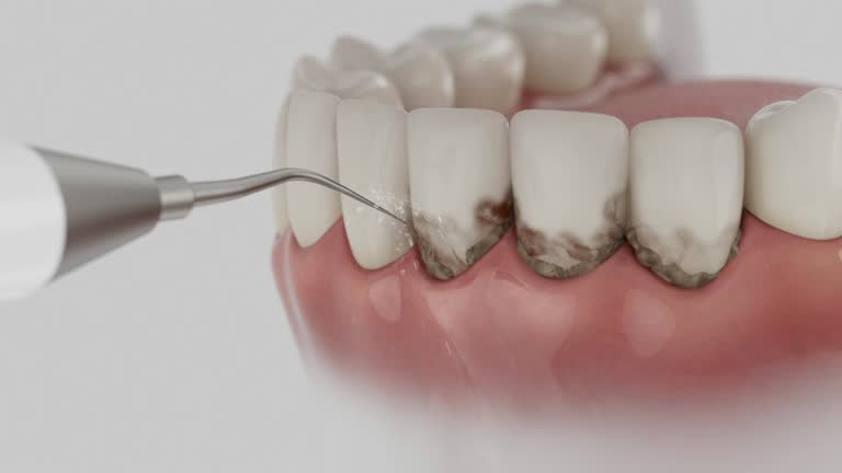 Trusted Tooth Extraction service in Granville South, OH - Dentist Open Now
